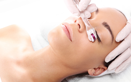Needling – for a beautiful skin. 